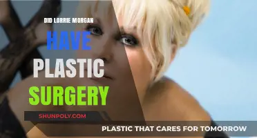 Lorrie Morgan's Transformation: Plastic Surgery Speculations and Truths Revealed