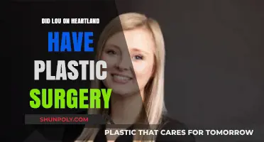 Did Lou from Heartland Undergo Plastic Surgery? Unveiling the Truth