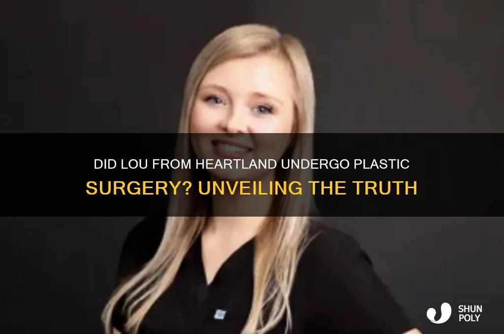did lou on heartland have plastic surgery