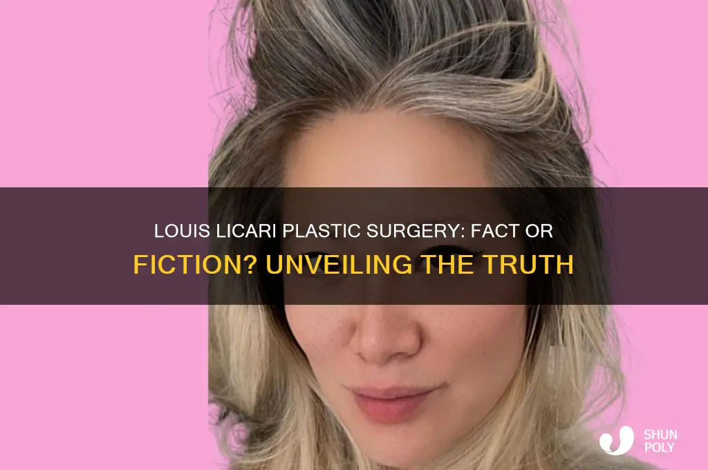 did louis licari have plastic surgery