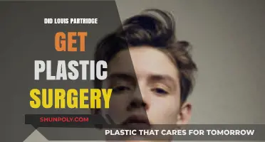 Louis Partridge Plastic Surgery Rumors: Fact or Fiction?