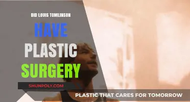 Louis Tomlinson's Transformation: Plastic Surgery Rumors Explored