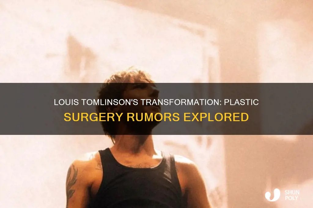 did louis tomlinson have plastic surgery