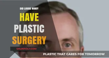 Louise Robey Plastic Surgery: Fact or Fiction? Unveiling the Truth