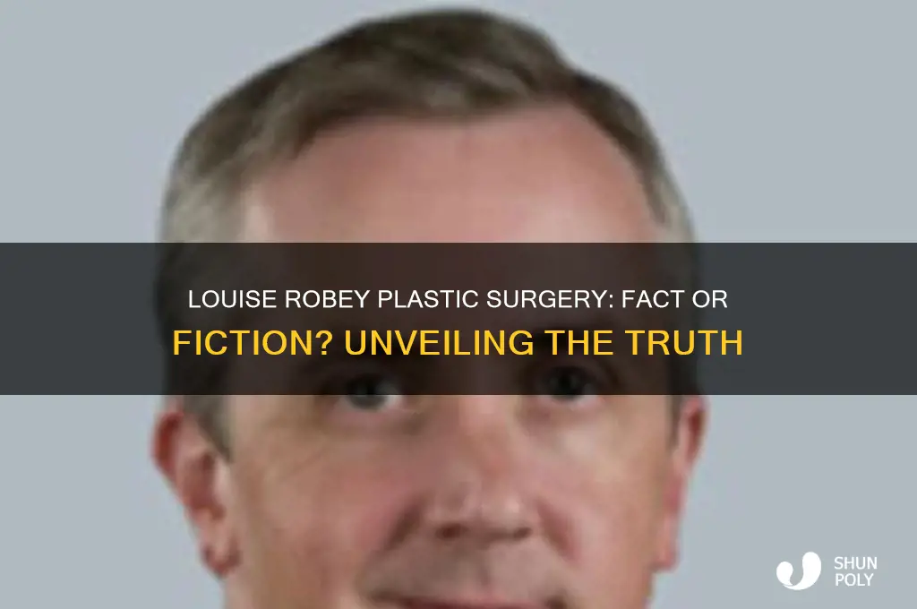 did louise robey have plastic surgery