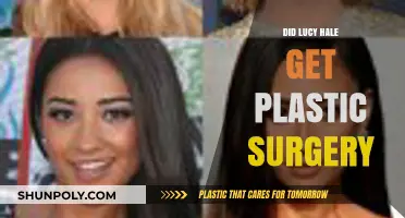 Lucy Hale Plastic Surgery: Fact-Checking the Rumors and Speculations