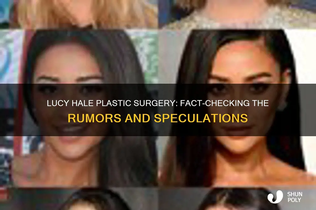 did lucy hale get plastic surgery