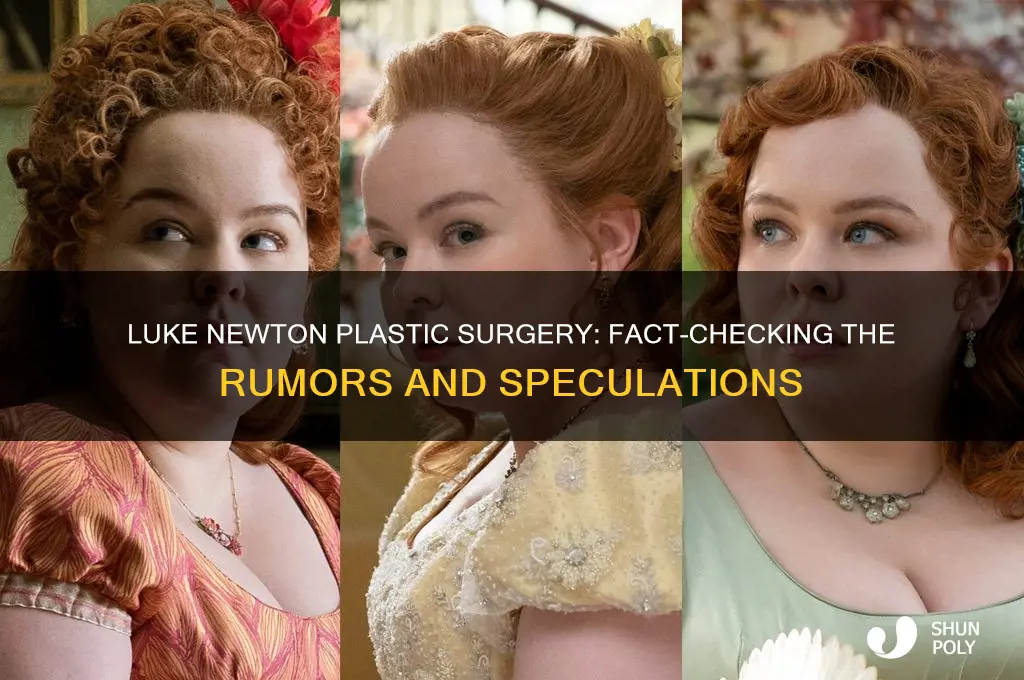 did luke newton have plastic surgery
