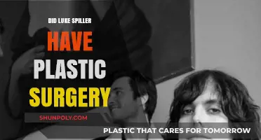 Luke Spiller Plastic Surgery: Fact or Fiction? Unveiling the Truth