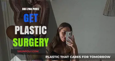 Lyna Perez Plastic Surgery: Fact-Checking Her Transformation Rumors