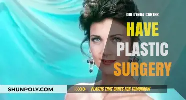 Lynda Carter's Ageless Beauty: Plastic Surgery Speculations Explored