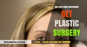 Lynn from Girlfriends: Plastic Surgery Speculations and Transformation Truths