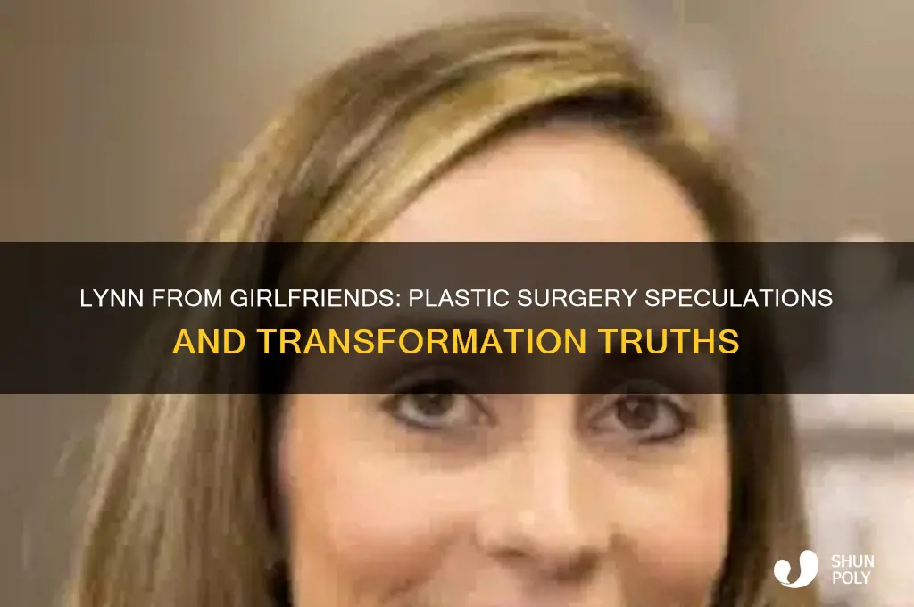 did lynn from girlfriends get plastic surgery
