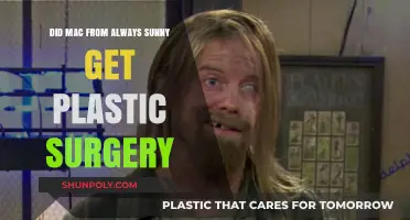 Did Mac from Always Sunny Undergo Plastic Surgery? The Truth Revealed