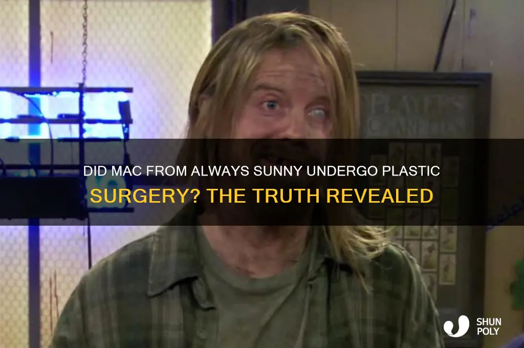 did mac from always sunny get plastic surgery