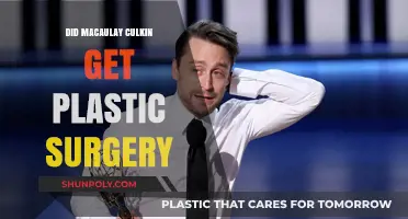 Macaulay Culkin Plastic Surgery: Fact or Fiction?