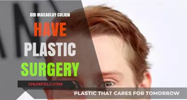 Macaulay Culkin Plastic Surgery: Fact or Fiction? Unveiling the Truth