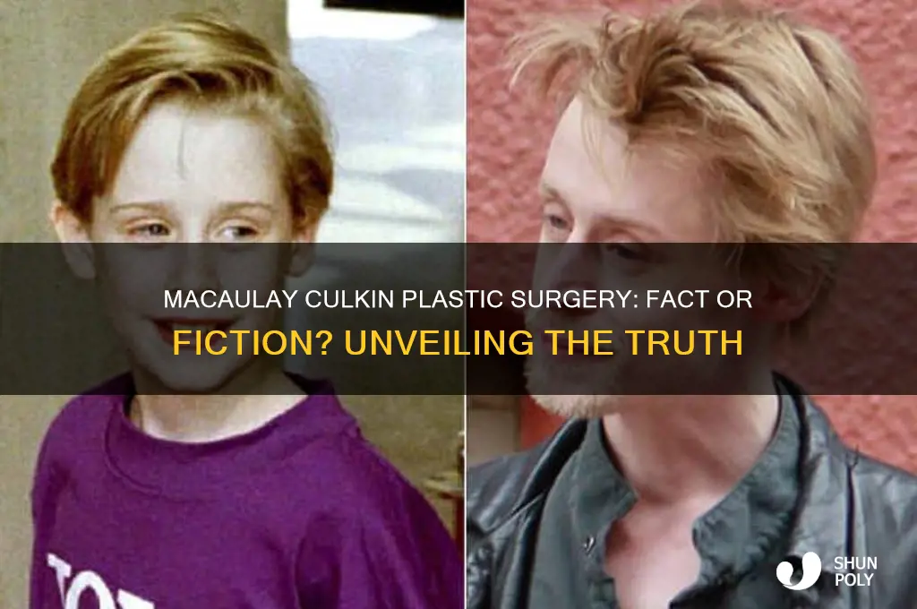 did macaulay culkin have plastic surgery