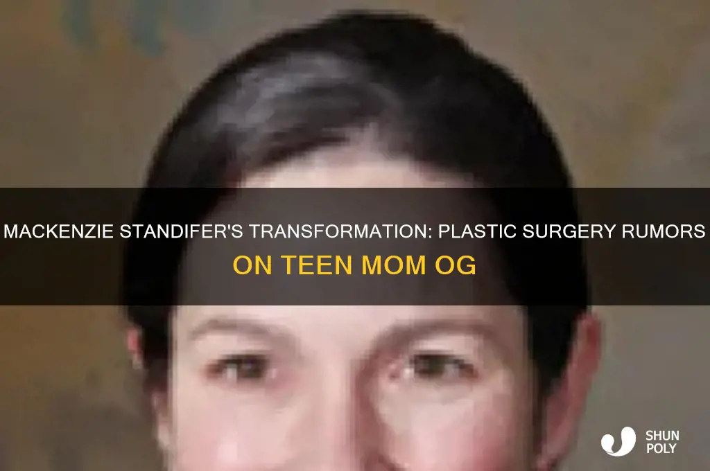did mackenzie standifer get plastic surgery on teen mom og