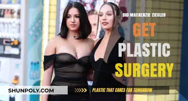 Mackenzie Ziegler Plastic Surgery: Fact-Checking the Rumors and Speculations