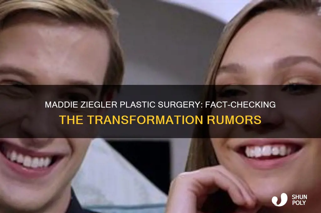 did maddie ziegler get plastic surgery