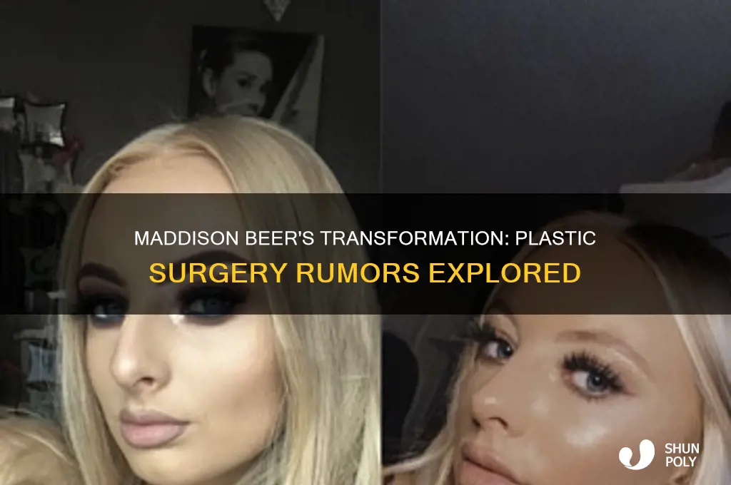 did maddison beer get plastic surgery
