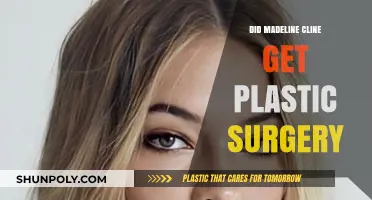 Madeline Cline Plastic Surgery: Fact-Checking the Transformation Rumors