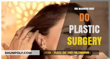 Madhuri Dixit's Transformation: Plastic Surgery Rumors Explored
