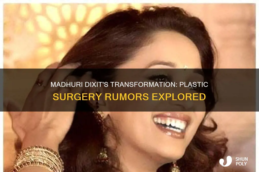 did madhuri dixit do plastic surgery