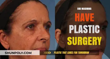 Unveiling the Truth: Did Madinna Undergo Plastic Surgery?
