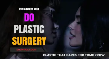 Madison Beer's Transformation: Plastic Surgery Speculations and Truths Revealed