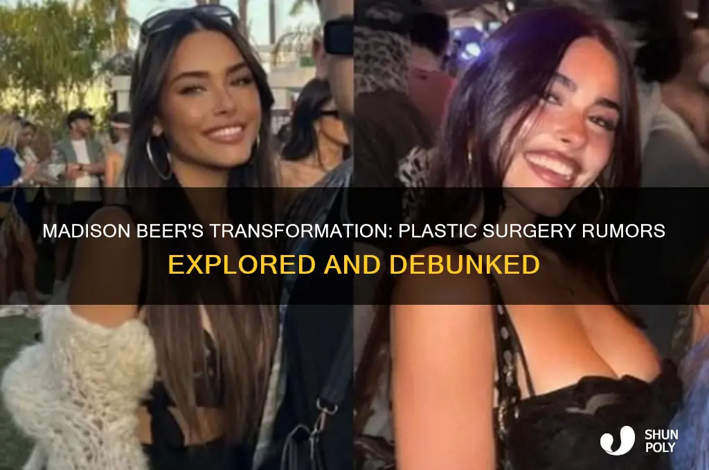 did madison beer get plastic
