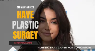 Plastic Surgery Speculation: Madison Beer's Transformation