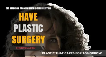 Madison Million Dollar Listing Plastic Surgery: Fact or Fiction?