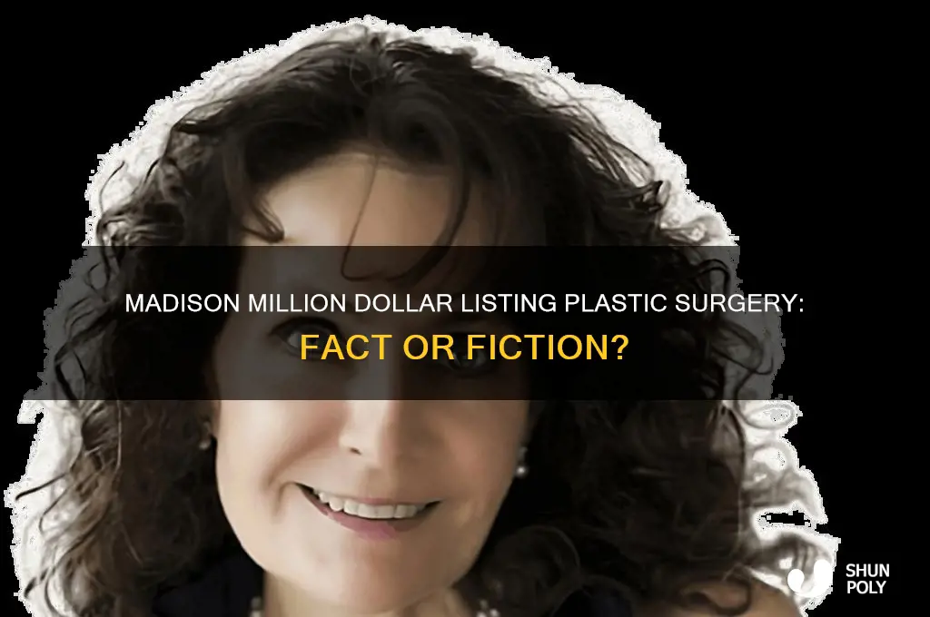 did madison from million dollar listing have plastic surgery