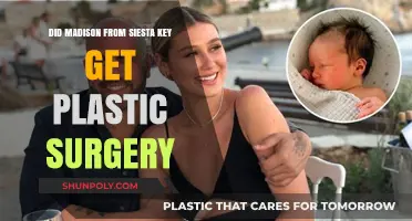 Madison from Siesta Key Plastic Surgery: Fact or Fiction?