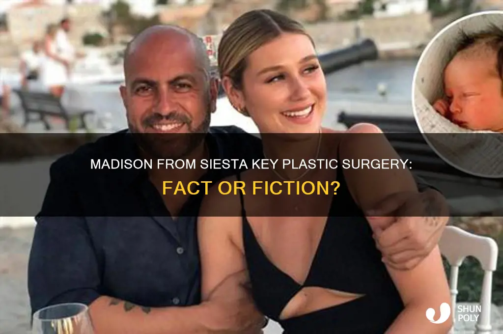 did madison from siesta key get plastic surgery