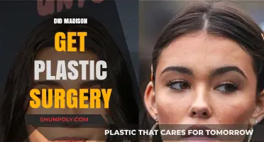 Madison's Transformation: Plastic Surgery Rumors and the Truth Behind Them