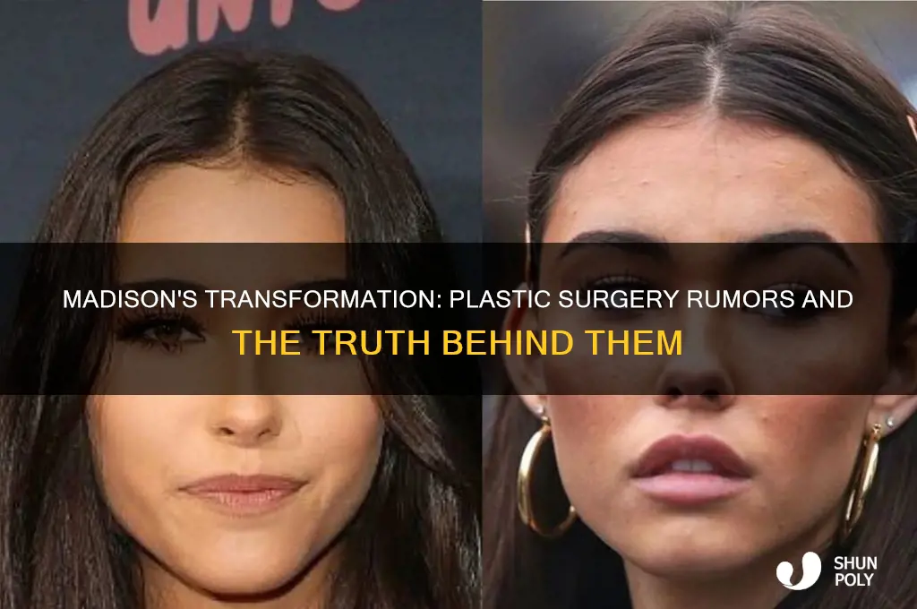 did madison get plastic surgery