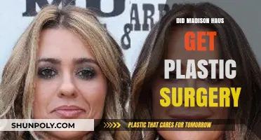 Madison Haus Plastic Surgery: Fact-Checking the Transformation Rumors