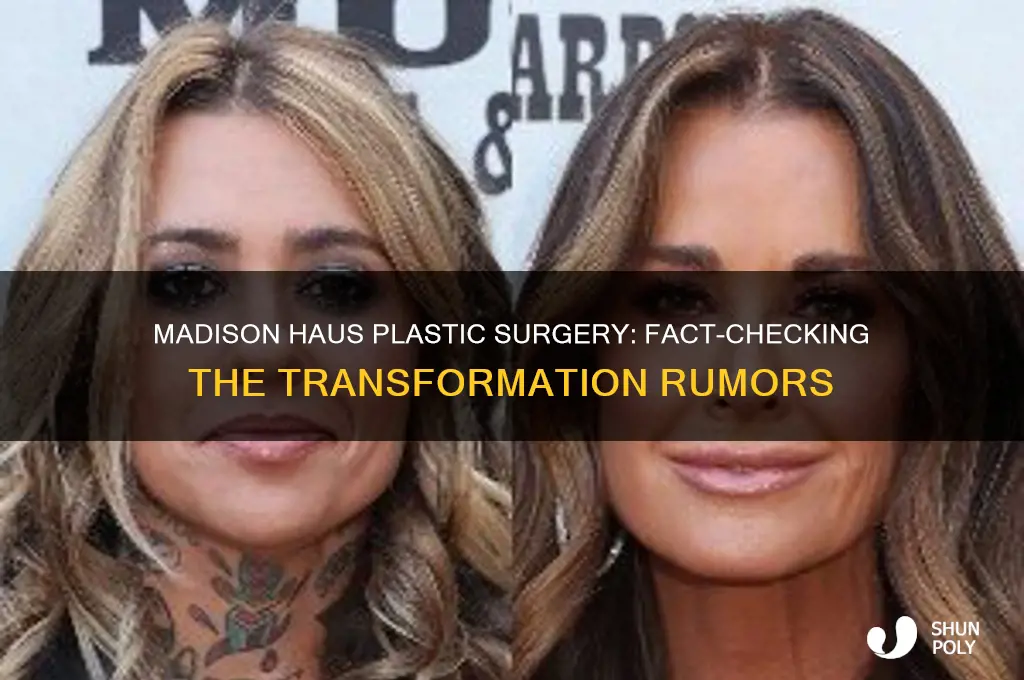 did madison haus get plastic surgery