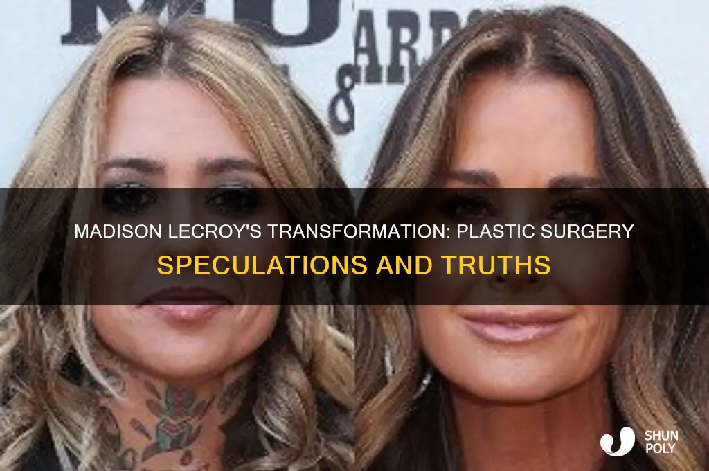 did madison lecroy get plastic surgery