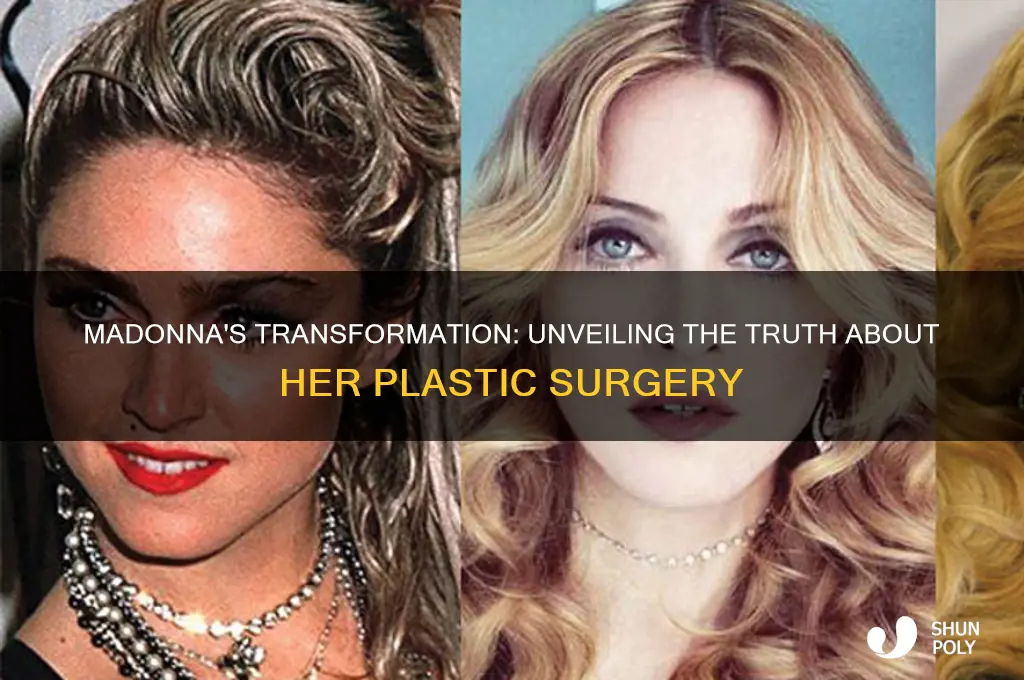 did madonna do plastic surgery