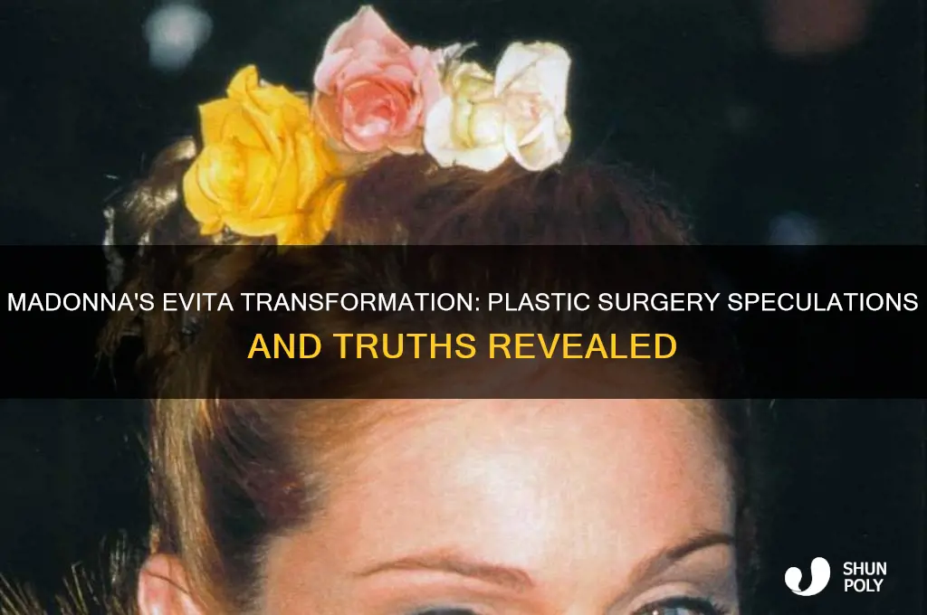 did madonna get plastic surgery for evita