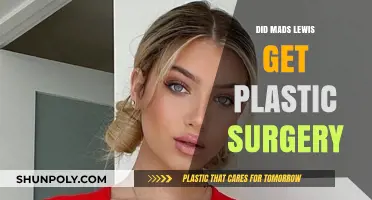Mads Lewis Plastic Surgery Rumors: Fact or Fiction?