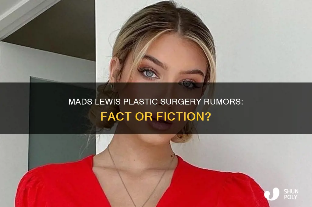 did mads lewis get plastic surgery
