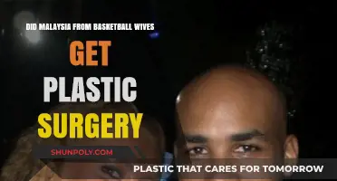Malaysia from Basketball Wives: Plastic Surgery Speculations and Transformation