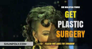 Malaysia Pargo's Transformation: Plastic Surgery Rumors Explored and Debunked