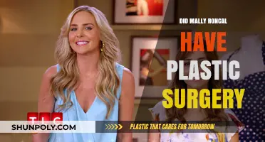 Mally Roncal's Transformation: Plastic Surgery Speculations and Truths