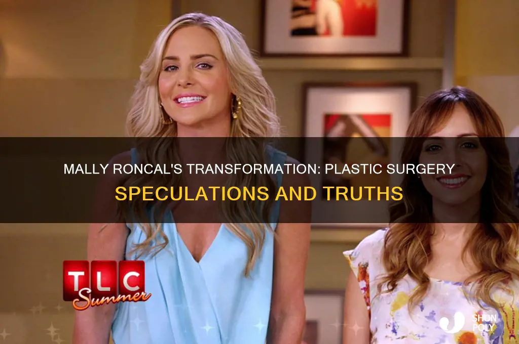 did mally roncal have plastic surgery